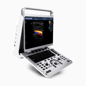 Ultrasound Machine Ebit 20 Main Unit with 3 Probes & Printer