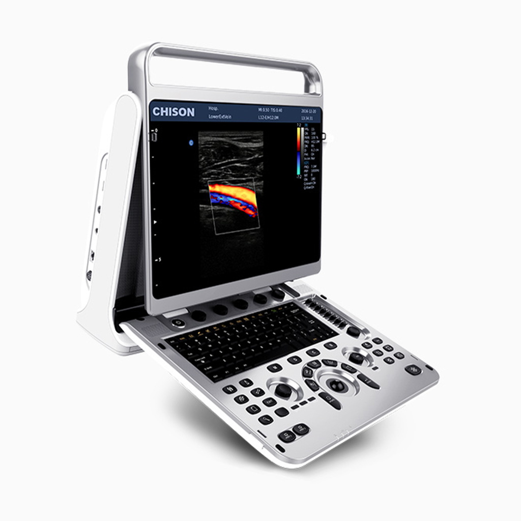 Ultrasound Machine Ebit 20 Main Unit with 3 Probes & Printer